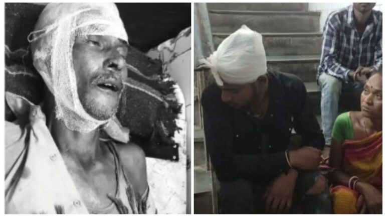 Road Accident: चांडिल के शहरबेड़ा मोड़ पर सड़क हादसे में बाइक सवार पिता की मौत, हो गई, दो बेटे गंभीर, ट्रेलर जब्त, चालक हिरासत में