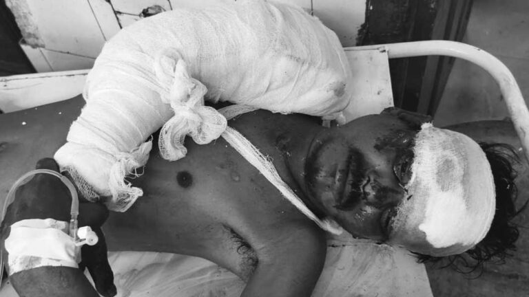 Saraikela Accident : चांडिल रेलवे स्टेशन के पास में ट्रेलर की टक्कर से आदित्यपुर के युवक की MGM में मौत, ट्रेलर जब्त