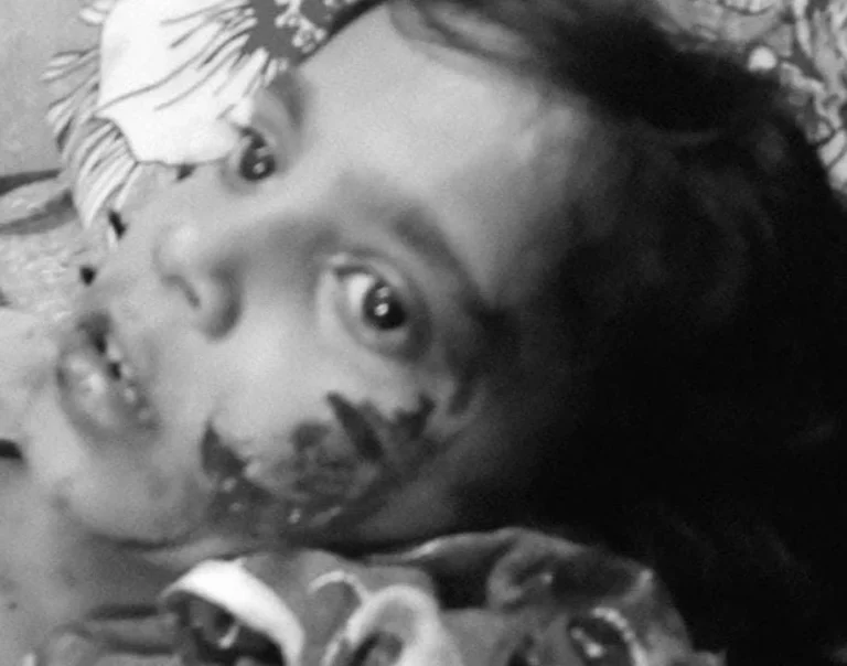 JAMSHEDPUR : घर के बाहर खेल रही बच्ची पर आवारा कुत्ते का हमला, गाल में काटा, लगाने पड़े 12 टांके