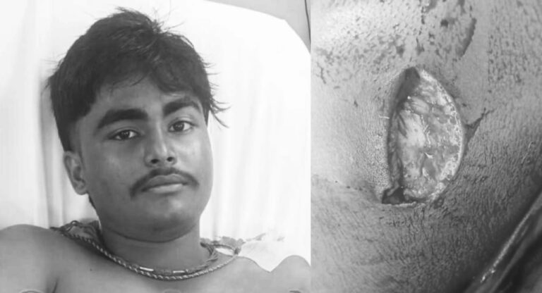 Jamshedpur Crime: जेआरडी स्पोर्ट्स कॉम्प्लेक्स से आर्चरी अभ्यास कर लौट रहे किशोर पर बाइक सवार बदमाशों ने किया चापड़ से हमला, यह है वजह?