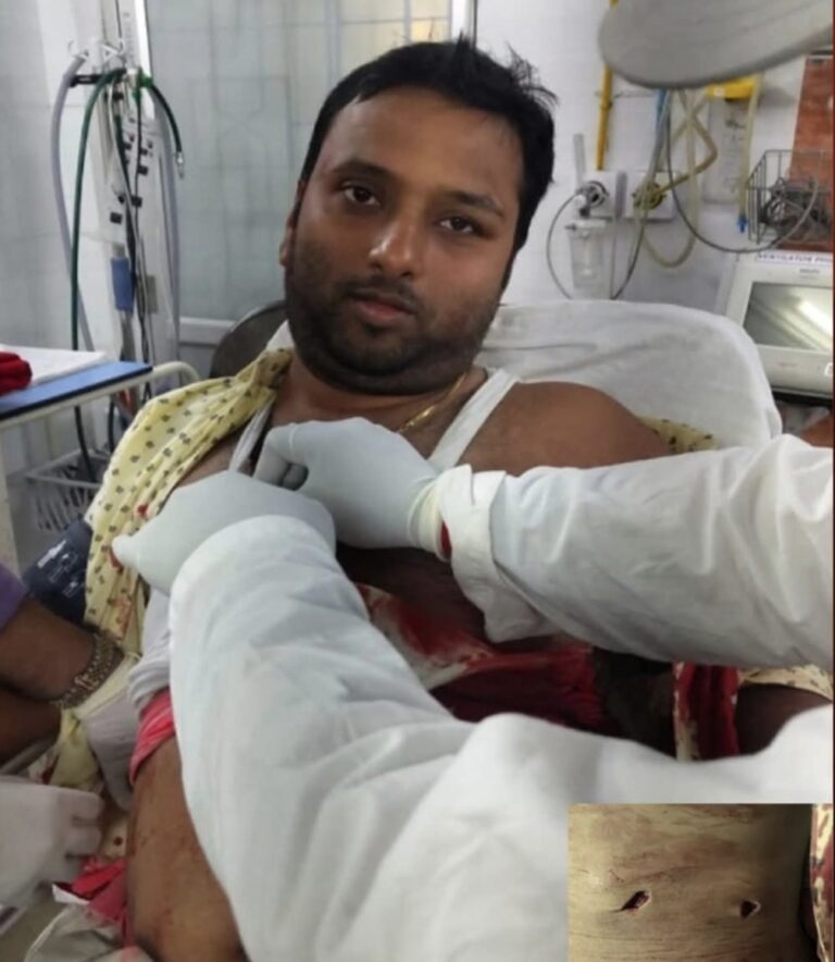 Jamshedpur: साकची में बड़ी वारदात,1000 रुपये के लिए चिरंजी लाल एंड संस के मालिक विशाल अग्रवाल को पूर्व कर्मचारी ने मारा चाकू,आरोपी गिरफ्तार