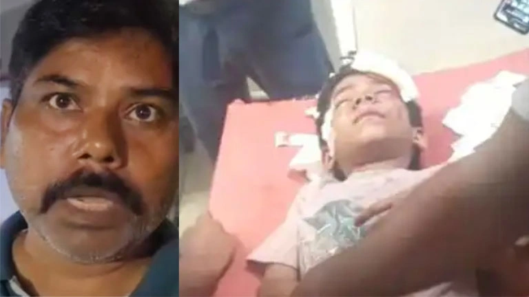 पर्स लूटने में नाकाम रहे बदमाश, सड़क पर गिरकर मां-बेटा घायल
